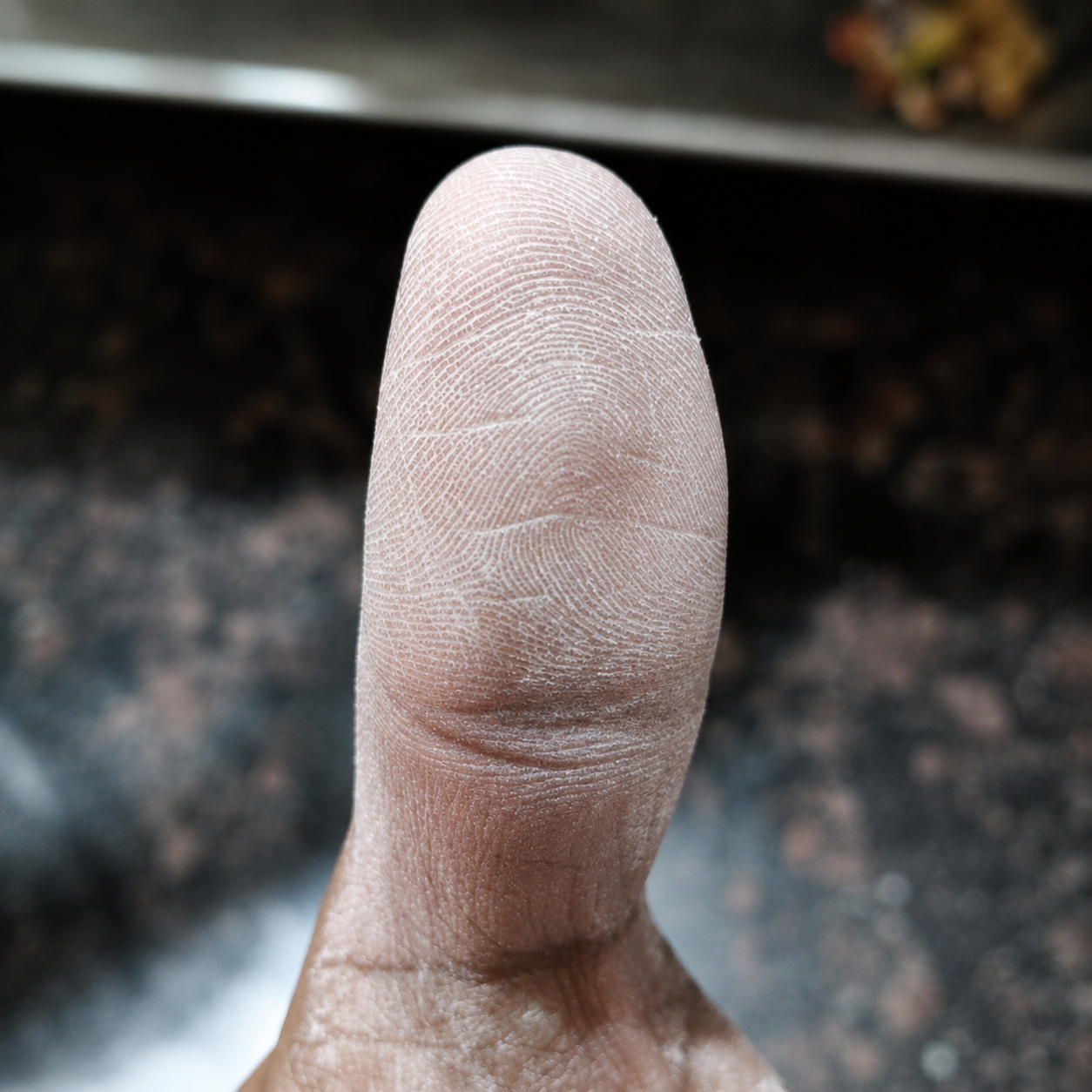 Sample of a thumb dusted with talcum powder showing clear ridges